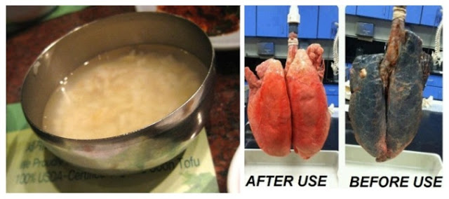 This Recipe Will Easily Clear Your Lungs In 3 Days, Even If You Smoke