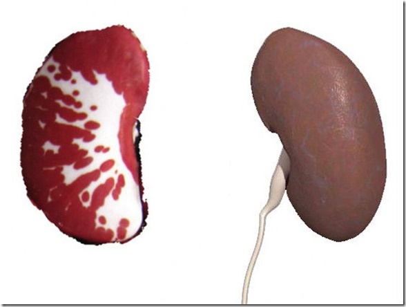 The Kidneys and Beans