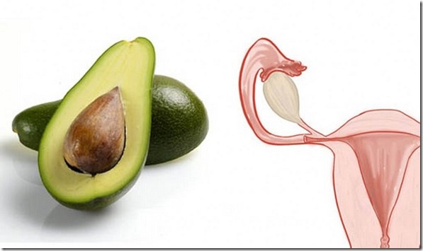 Uterus and Avocadoes