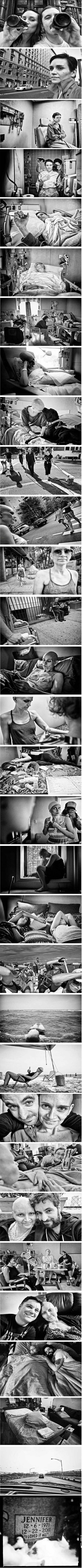 Photographer takes a picture every stage his girlfriend went through in her battle with cancer