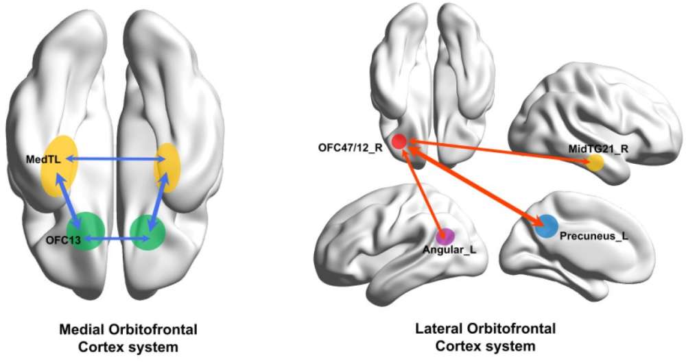 "The human medial (reward-related, OFC13) and lateral (non-reward-related, OFC47/12) orbitofrontal cortex networks that show different functional connectivity in patients with depression." University of Warwick