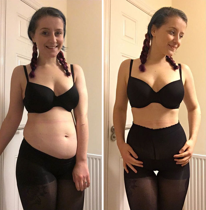 Before And After Photos Prove Perfect Body Images Can Be 